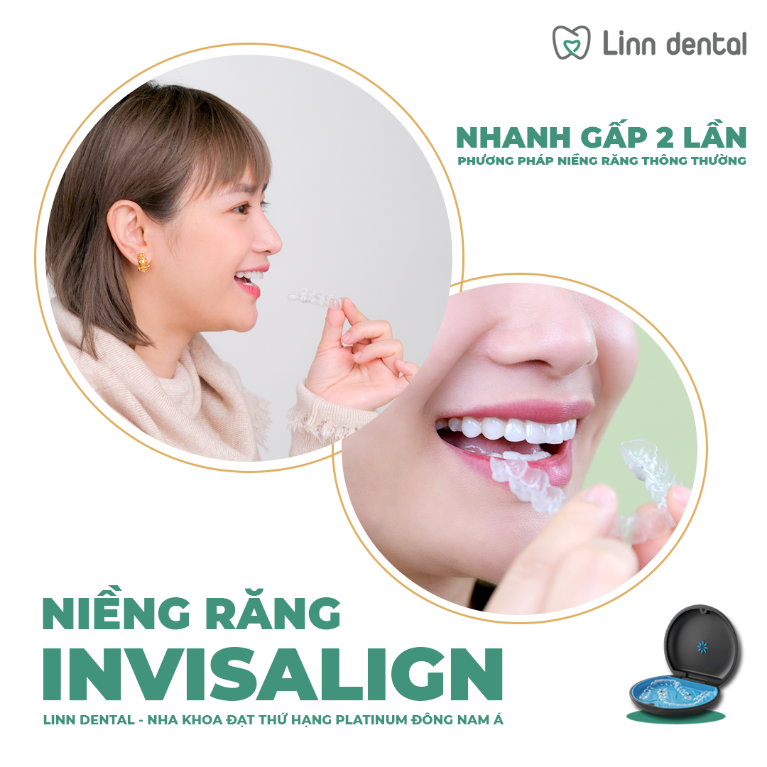 Niềng răng invisalign