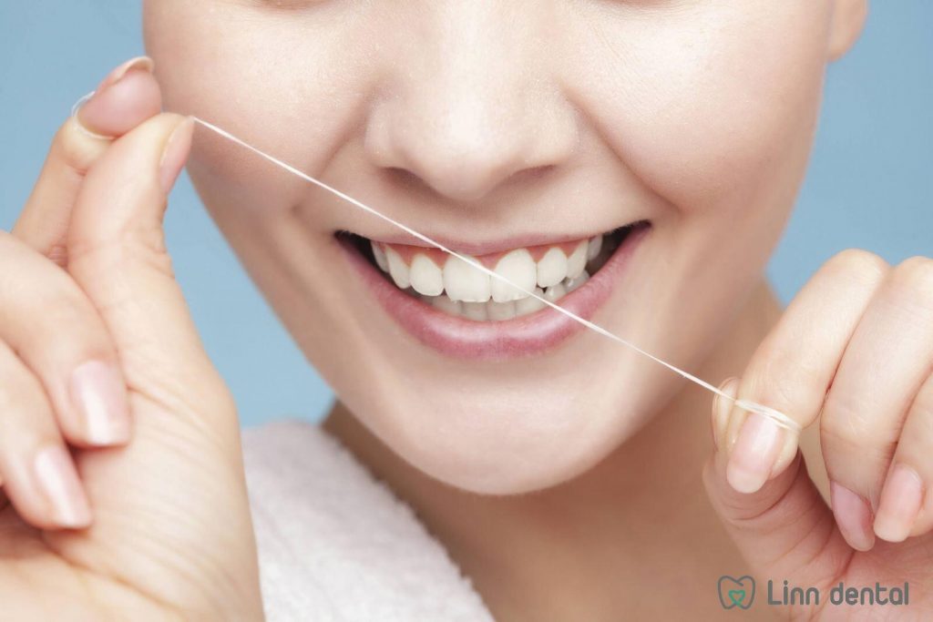 Chỉ nha khoa là phương pháp hiệu quả bảo toàn răng sứ veneer